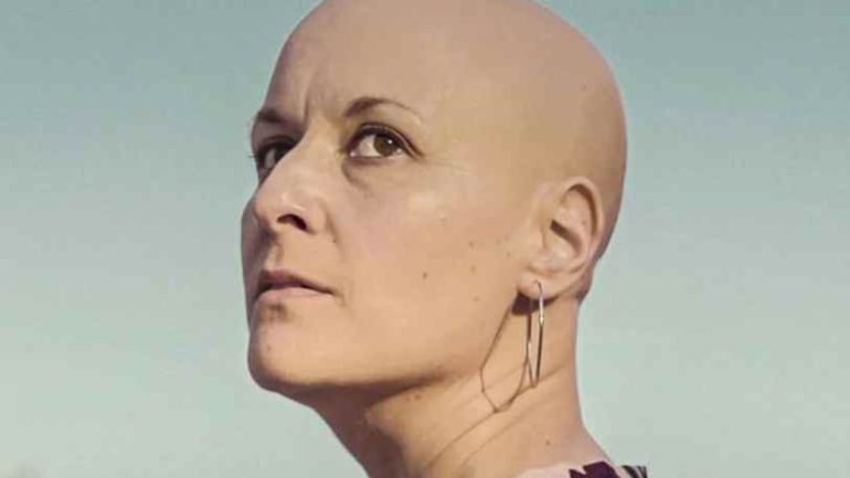 El documental “Mujeres calvas”, sobre la alopecia femenina, llega este jueves a Elche
